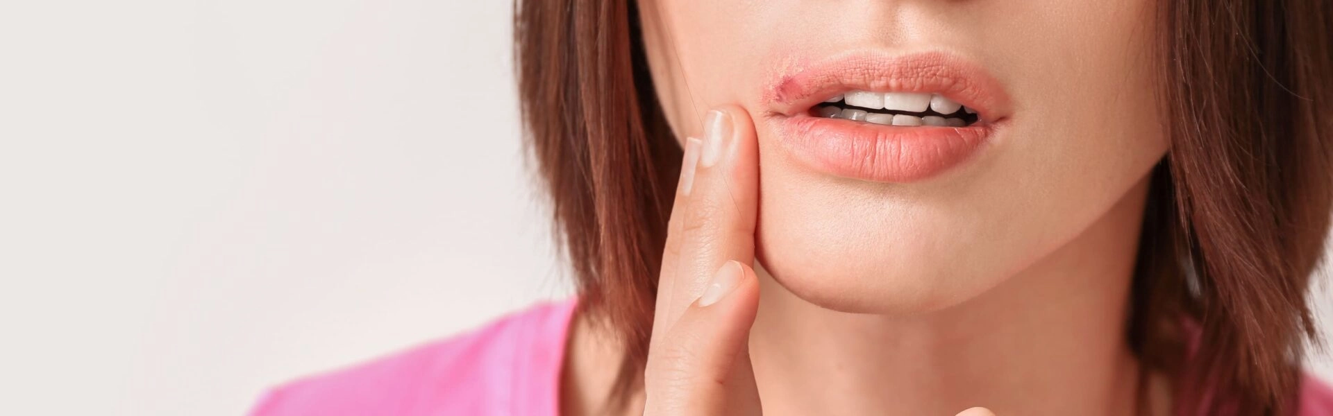 Is a cold sore contagious?