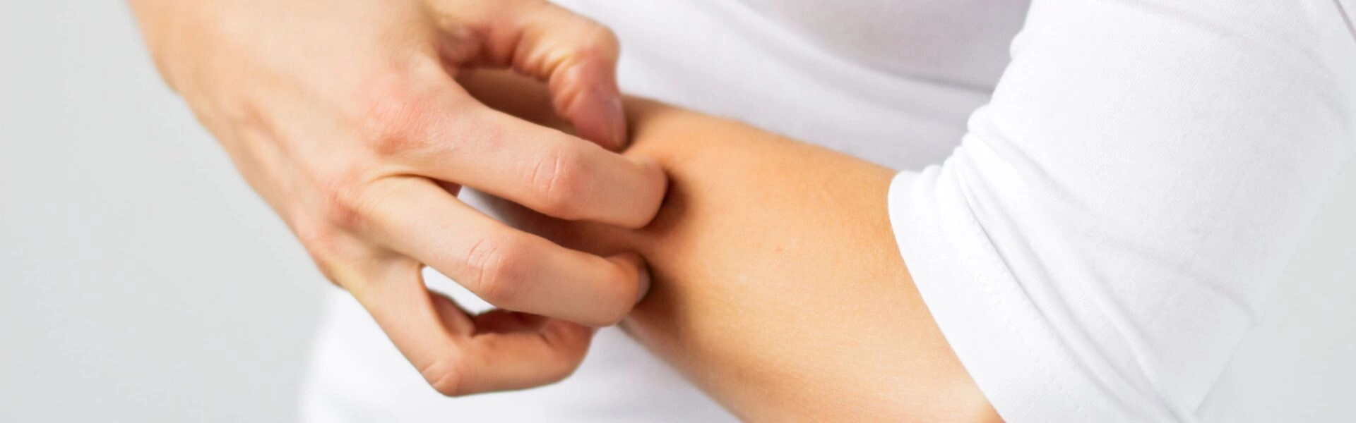 What to do in case of insect bites?