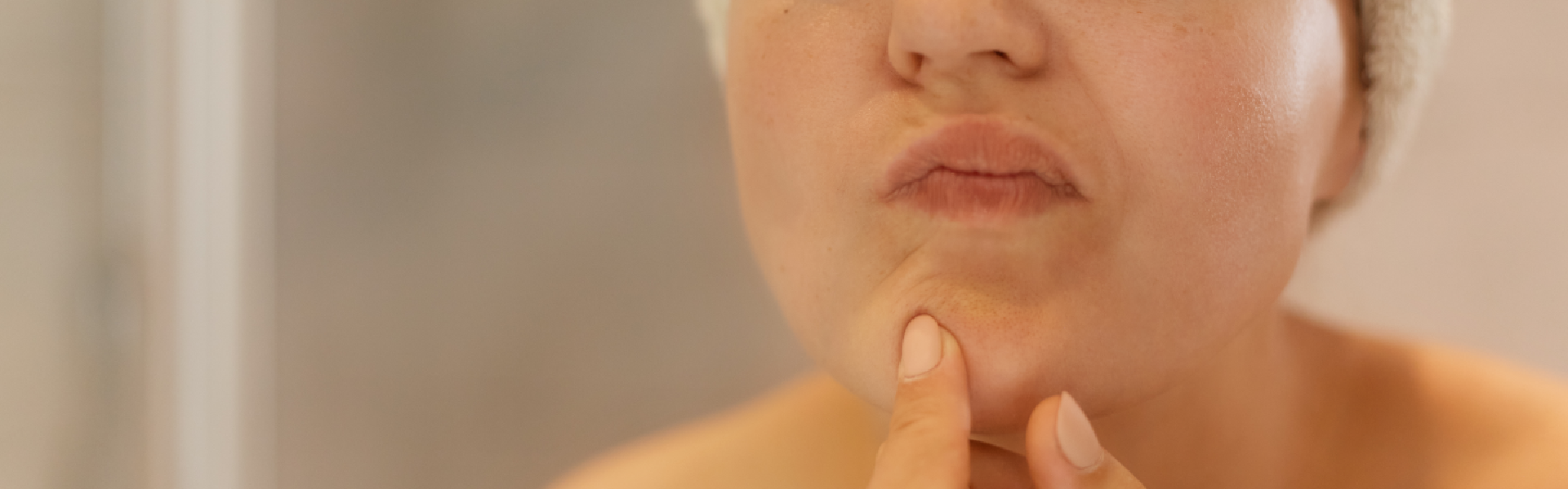 Why can you still get pimples at 30?